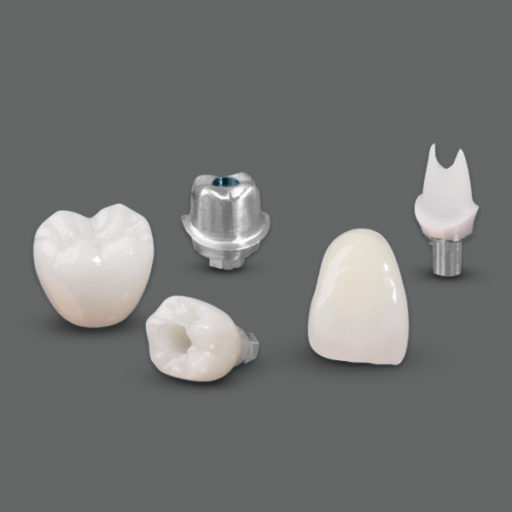 Restorations Over Implants SmithSterling Dental Laboratories